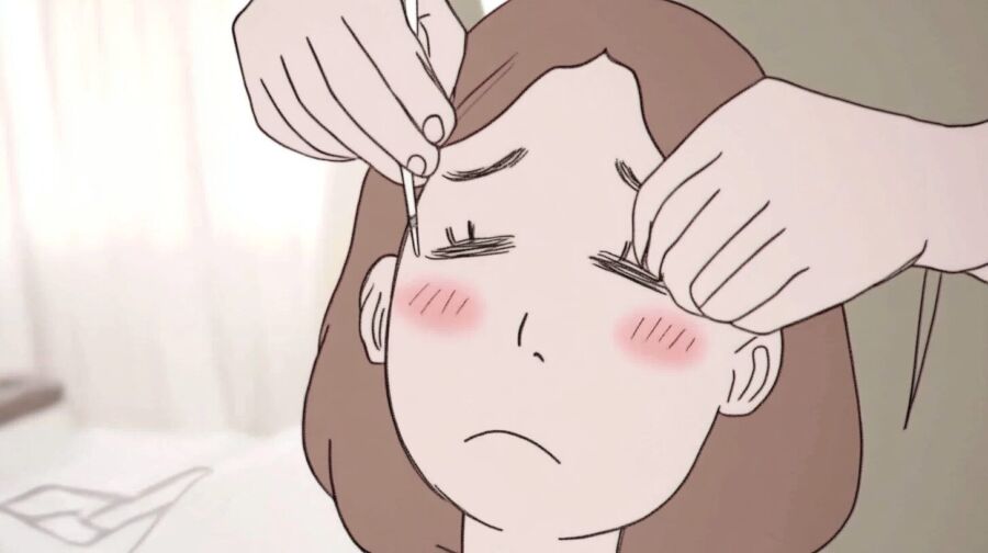 まぶたのたるみ手術の種類と方法