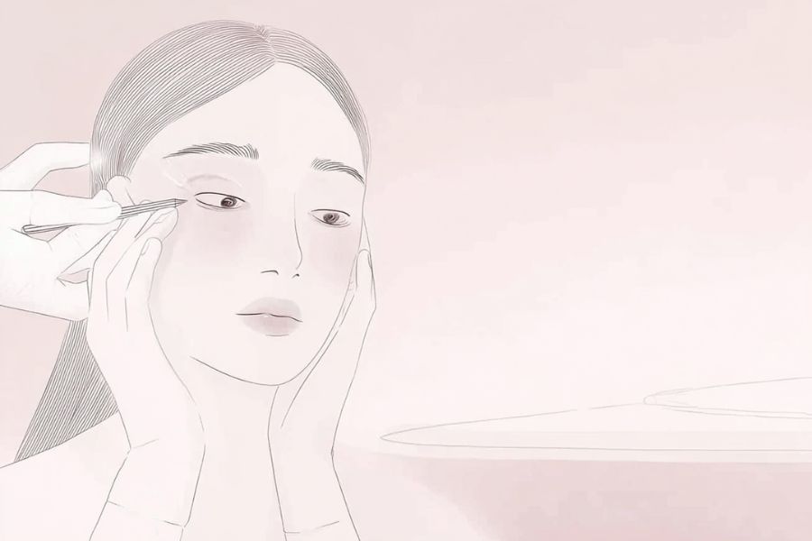一重まぶたのたるみ解消方法
