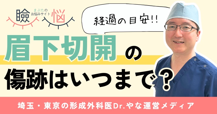 【医師監修】眉下切開の傷跡はいつまで？長引きやすい人の特徴5選
