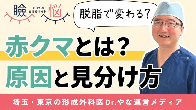 【医師監修】赤クマとは？原因と見分け方、脱脂で変わるケース・残るケース